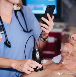 医生用iPhone式超声仪发现自己患癌了